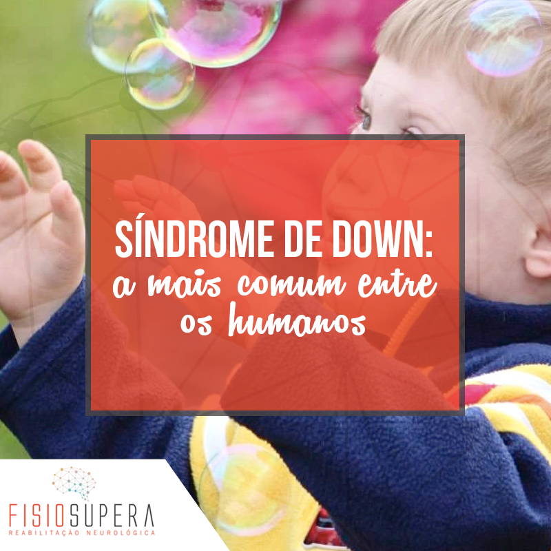 Read more about the article Síndrome de Down